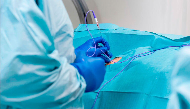 PROCEDURE--0--